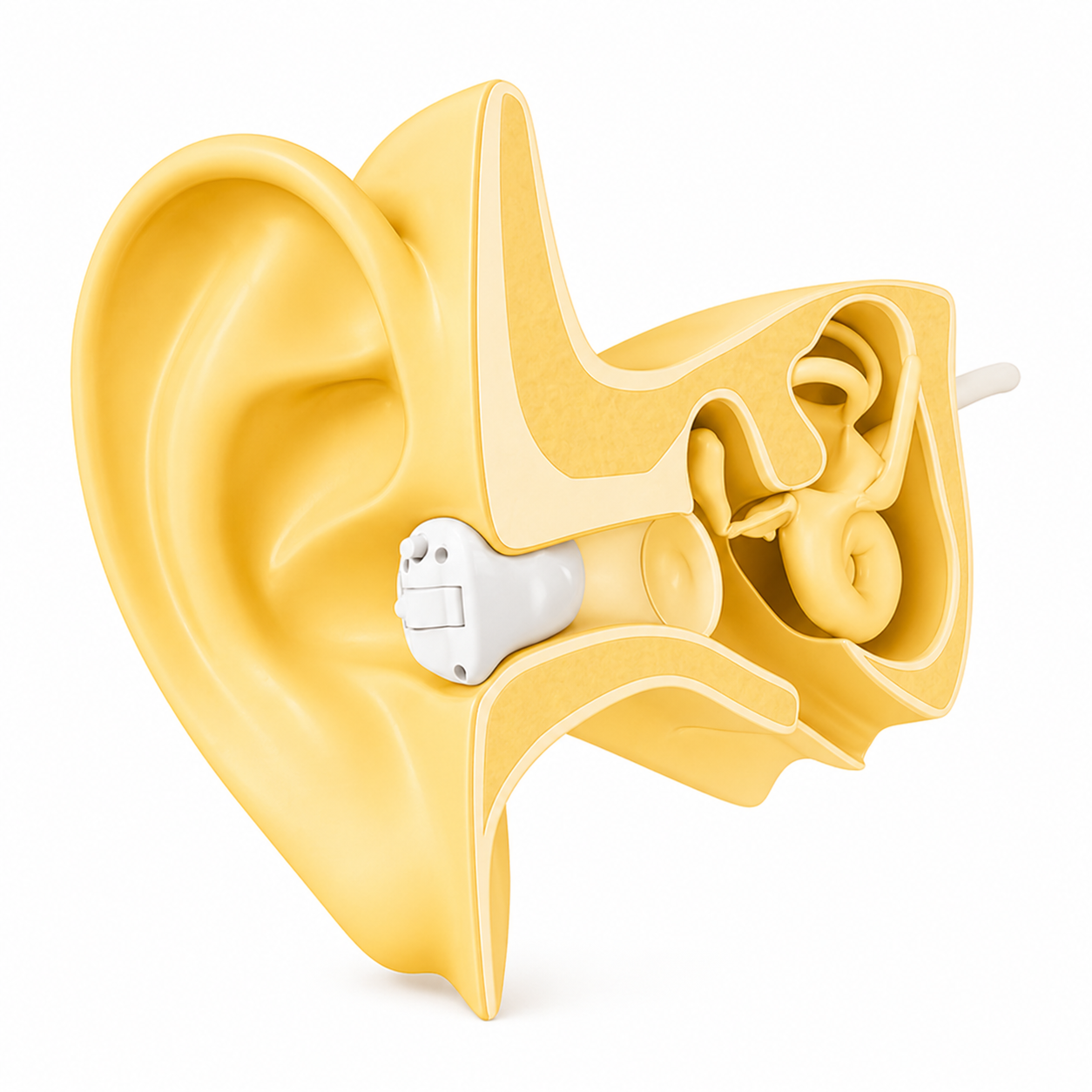 1 Why ITC hearing aid